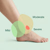 Fivali How to Identify Mild Moderate and Severe Ankle Sprains - News