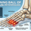 Understanding and Managing Ball of Foot Pain