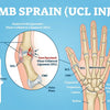 Understanding Your Thumb Sprain Causes Symptoms Recovery