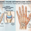 Understanding Thumb Arthritis Causes Symptoms Management