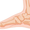Understanding and Managing Ankle Instability