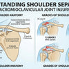 Understanding Shoulder Separation Causes Symptoms and Recovery
