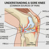 Sore Knees Understanding Causes Symptoms and Relief